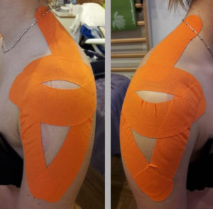 Vállizület Kinesio-Tape